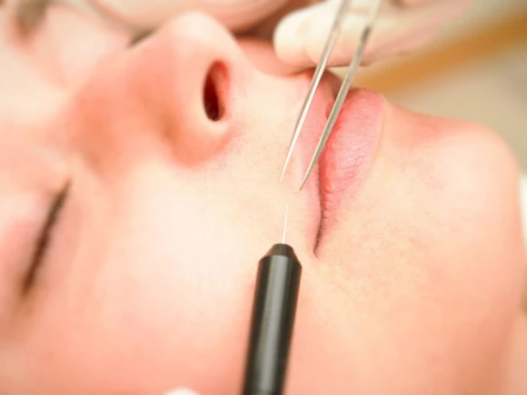 renske ypma skin clinics medewerkers