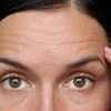 Everything you need to know about acne and effective treatments cover