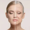 Everything you need to know about acne and effective treatments cover
