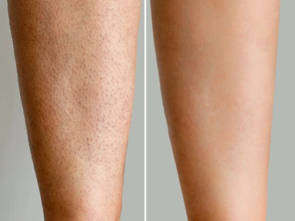renske ypma skin clinics medewerkers