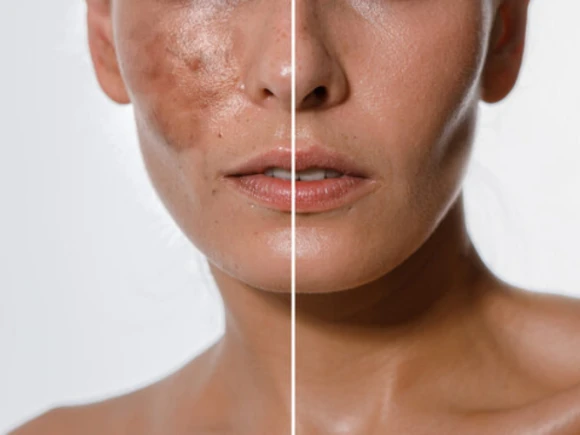 renske ypma skin clinics medewerkers