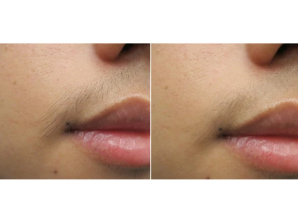 renske ypma skin clinics medewerkers