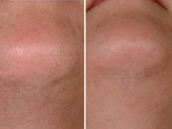 renske ypma skin clinics medewerkers