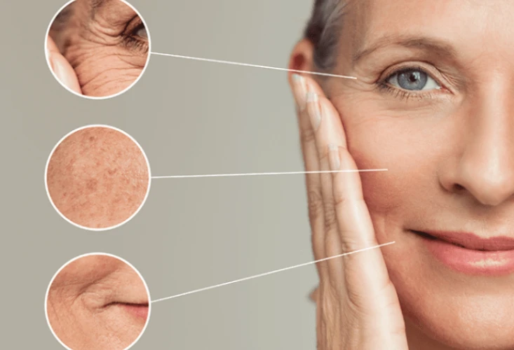 vitamin c summer peel
