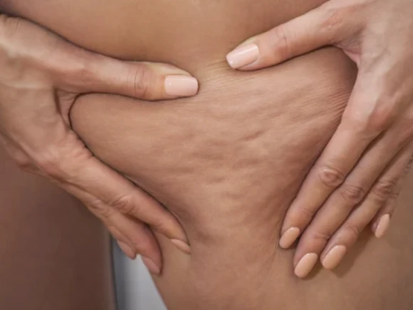 renske ypma skin clinics medewerkers