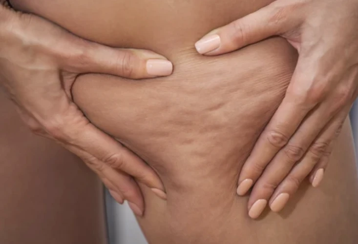 vitamin c summer peel