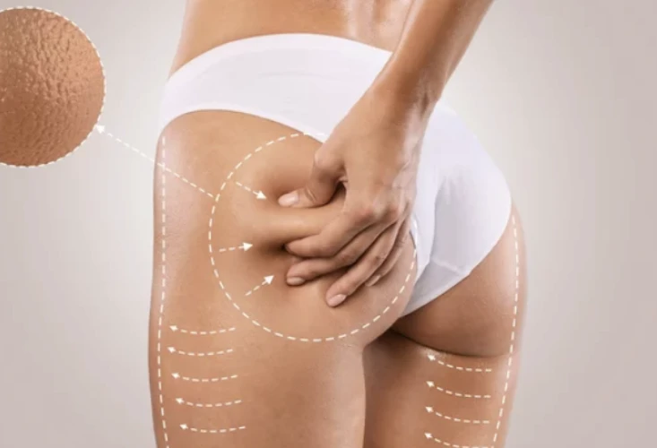 vitamine C peel voor na