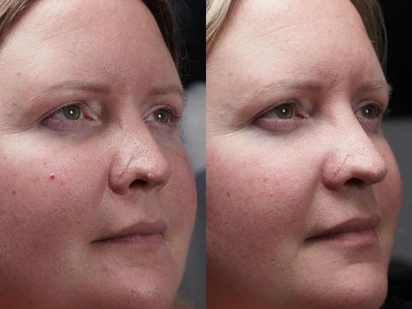 renske ypma skin clinics medewerkers