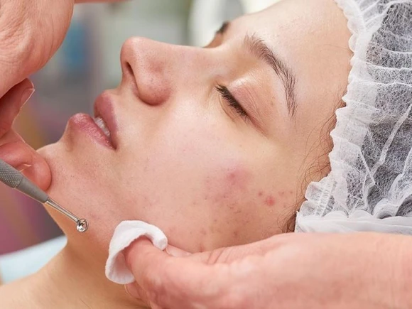 renske ypma skin clinics medewerkers