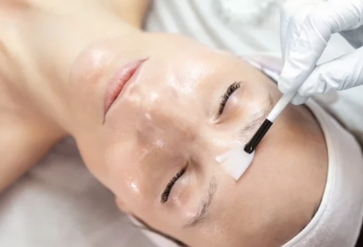 vitamin c summer peel