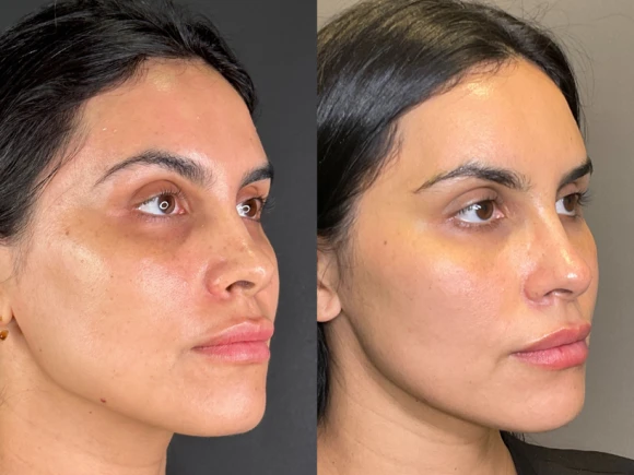 renske ypma skin clinics medewerkers