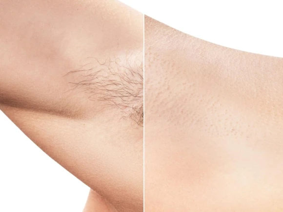 Everything you need to know about acne and effective treatments cover
