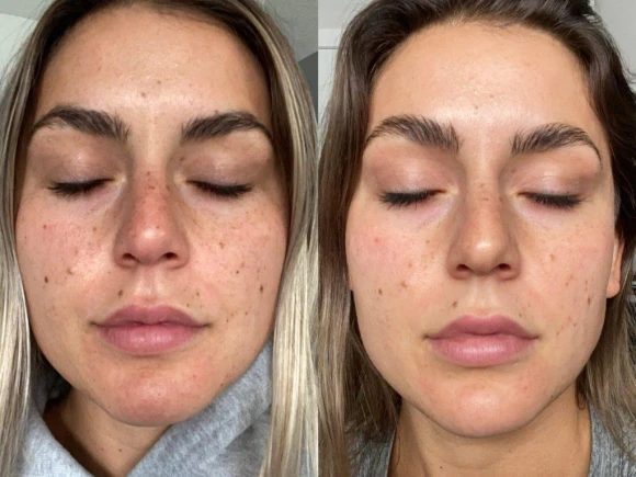 renske ypma skin clinics medewerkers