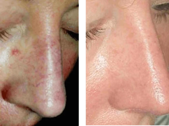 renske ypma skin clinics medewerkers