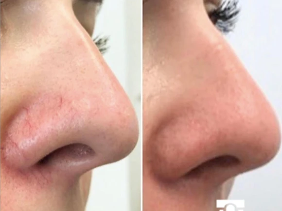 renske ypma skin clinics medewerkers