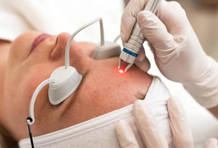 Everything you need to know about acne and effective treatments cover