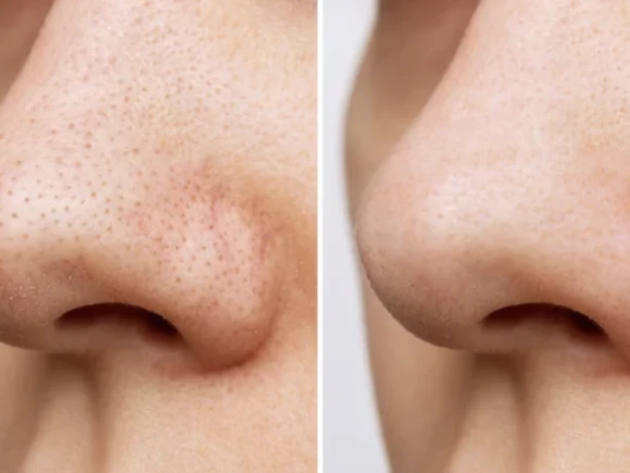renske ypma skin clinics medewerkers