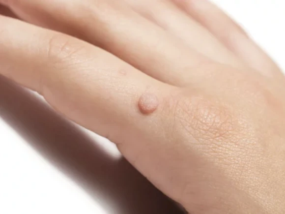 renske ypma skin clinics medewerkers