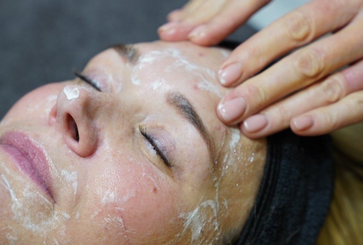 Alles wat je moet weten over acne en effectieve behandelingen