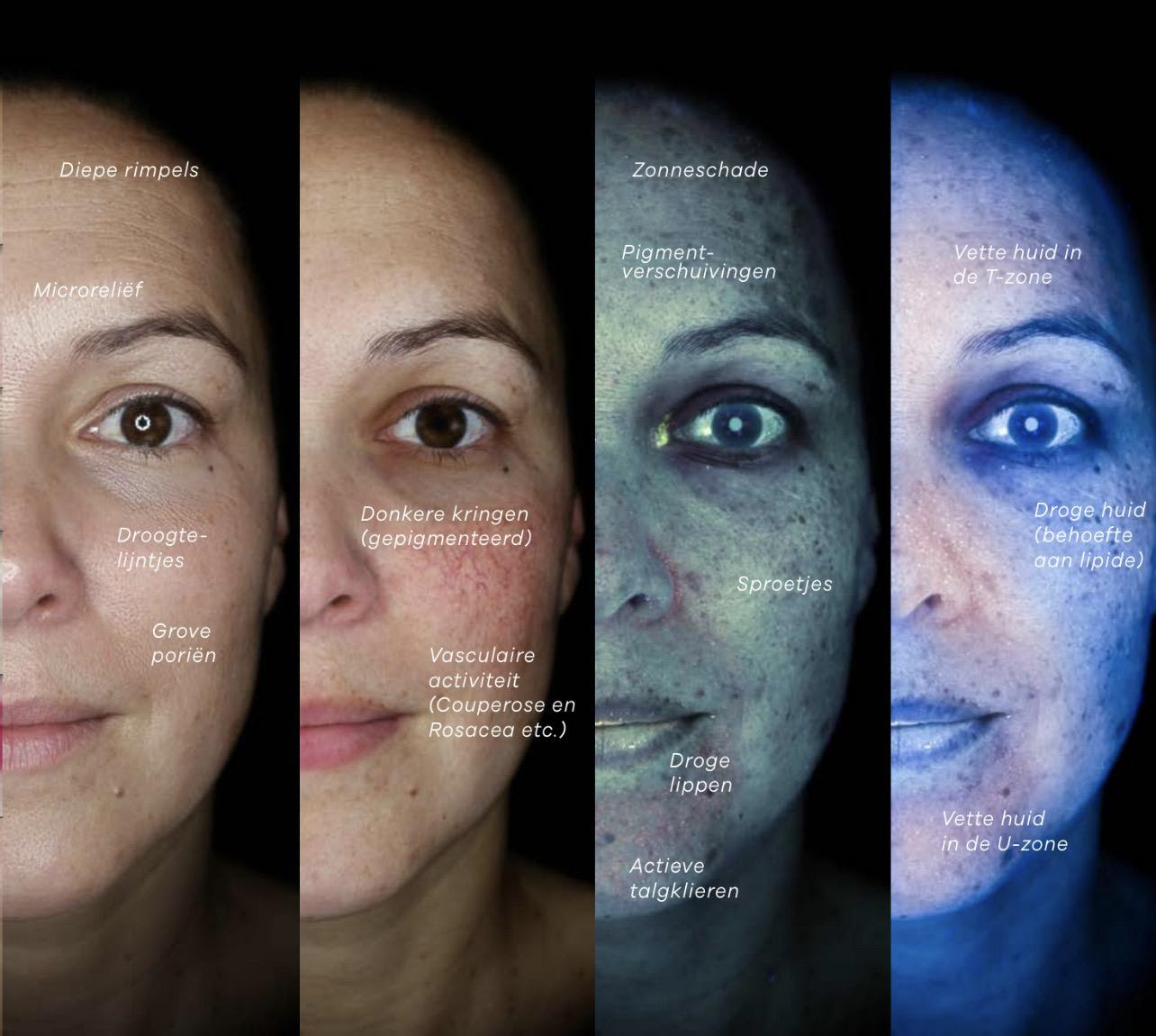 Everything you need to know about acne and effective treatments cover