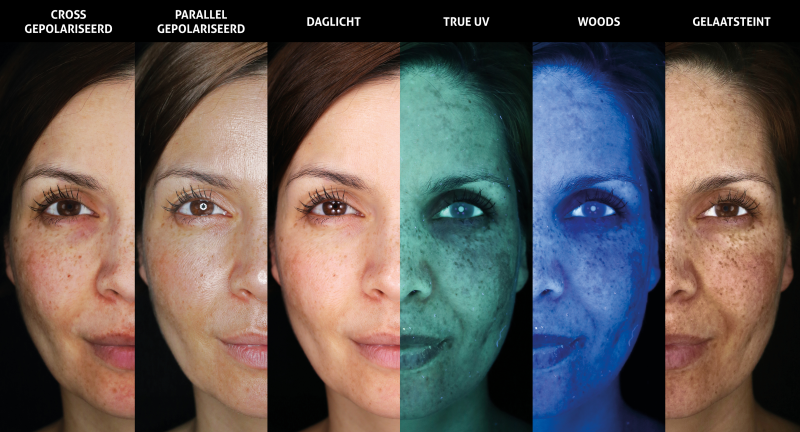 renske ypma skin clinics medewerkers